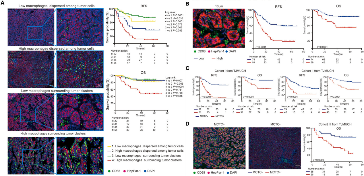 Cell 子刊丨HCC患者预后不良及肿瘤侵袭性的新发现