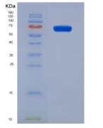 小鼠干扰素调节因子1(IRF1)重组蛋白