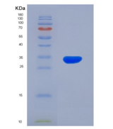 大鼠结缔组织生长因子(CTGF)重组蛋白