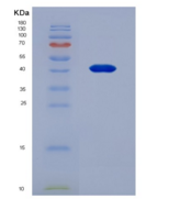 人核因子κB受体激活因子(RANk)重组蛋白