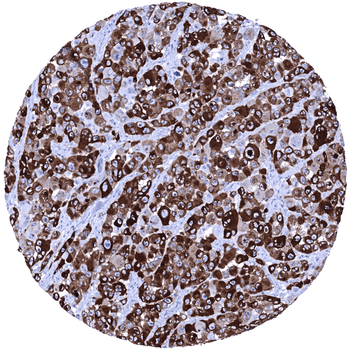 PMEL / gp100 / Melanosome anti