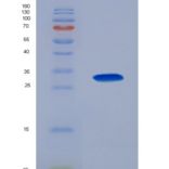 人Ⅺ型胶原α1(COL11a1)重组蛋白
