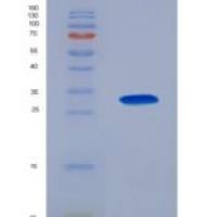 人Ⅺ型胶原α1(COL11a1)重组蛋白