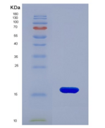 人胱天蛋白酶9(CASP9)重组蛋白