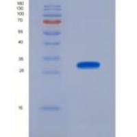 小鼠神经元正五聚蛋白Ⅱ(NPTX2)重组蛋白