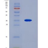人C-Ros癌基因1，受体酪氨酸激酶重组蛋白