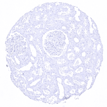 Cytokeratin 20 antibody 抗体，orb