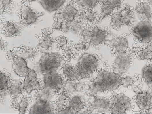 细胞异常形态大盘点