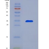人单核细胞趋化蛋白3(MCP3)重组蛋白