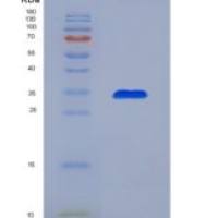 人单核细胞趋化蛋白3(MCP3)重组蛋白
