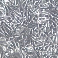 BT-549细胞、BT-549细胞系、BT-549乳腺癌细胞