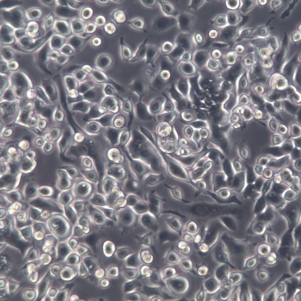 AsPC-1细胞、AsPC-1细胞系、AsPC-1转移胰腺癌细胞