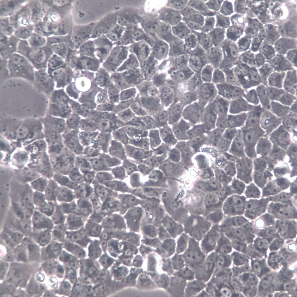 Caov-3细胞、Caov-3细胞系、Caov-3乳头状卵巢腺癌细胞