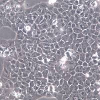 Caov-3细胞、Caov-3细胞系、Caov-3乳头状卵巢腺癌细胞