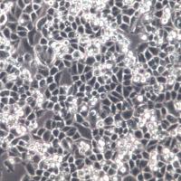 C-33A细胞、C-33A细胞系、C-33A宫颈癌细胞  