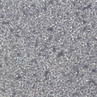 Nalm-6细胞、Nalm-6细胞系、Nalm-6前B急性淋巴细胞白血病细胞