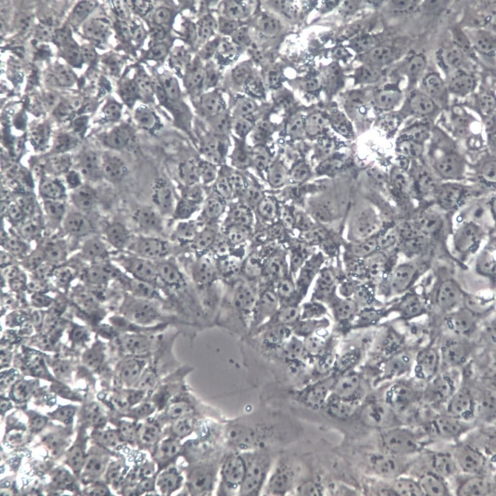 BeWo细胞、BeWo细胞系、BeWo胎盘绒膜癌细胞