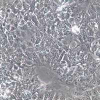 BeWo细胞、BeWo细胞系、BeWo胎盘绒膜癌细胞