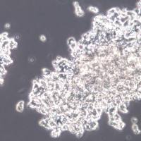 DMS153细胞、DMS153细胞系、DMS153小细胞肺癌细胞