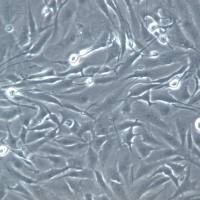 FTC-133 细胞系、FTC-133 细胞、FTC-133 甲状腺癌细胞