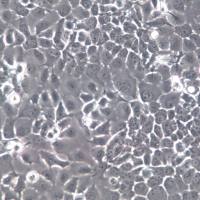 FaDu细胞系、FaDu细胞、FaDu咽鳞癌细胞  