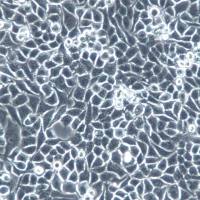 CNE-2细胞、CNE-2细胞系、CNE-2鼻咽癌细胞