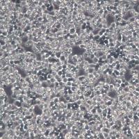 COLO320细胞、COLO320细胞系、COLO320结肠腺癌细胞