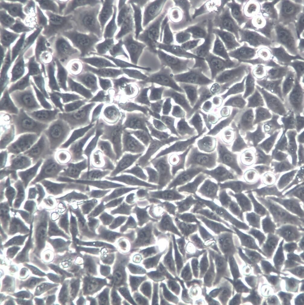 BEL-7402细胞、BEL-7402细胞系、BEL-7402肝癌细胞