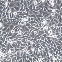 BEL-7402细胞、BEL-7402细胞系、BEL-7402肝癌细胞