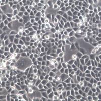 CNE细胞、CNE细胞系、CNE鼻咽癌细胞