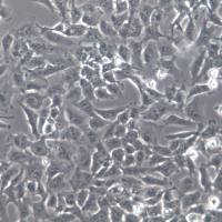 Nthy-ori 3-1细胞、Nthy-ori 3-1细胞系、Nthy-ori 3-1甲状腺正常细胞