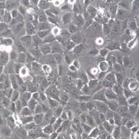 OVCAR-8细胞、OVCAR-8细胞系、OVCAR-8卵巢癌细胞