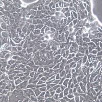 Calu-3细胞、Calu-3细胞系、Calu-3肺腺癌细胞