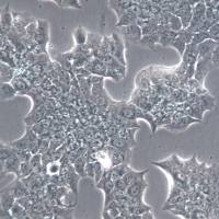 BT-474细胞、BT-474细胞系、BT-474乳腺导管瘤细胞   