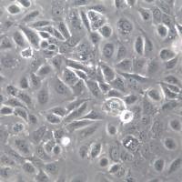 CaSki细胞、CaSki细胞系、CaSki宫颈癌细胞