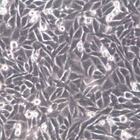 AN3CA细胞、AN3CA细胞系、AN3CA子宫内膜腺癌(转移)细胞