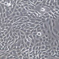 HSC3细胞系、HSC-3细胞、HSC-3口腔鳞癌细胞