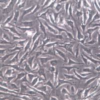 EA.hy926细胞、EA.hy926细胞系、EA.hy926脐静脉细胞融合细胞