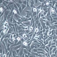 MNNG/HOS Cl #5 [R-1059-D] 细胞、MNNG/HOS Cl #5 [R-1059-D] 细胞系、MNNG/HOS Cl #5 [R-1059-D] 骨肉瘤细胞 