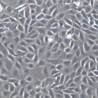 5637细胞、5637细胞系、5637膀胱癌细胞