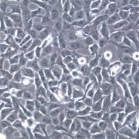 BCPAP细胞、BCPAP细胞系、BCPAP甲状腺癌乳头状细胞   