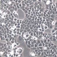 BGC-823细胞、BGC-823细胞系、BGC-823胃癌细胞