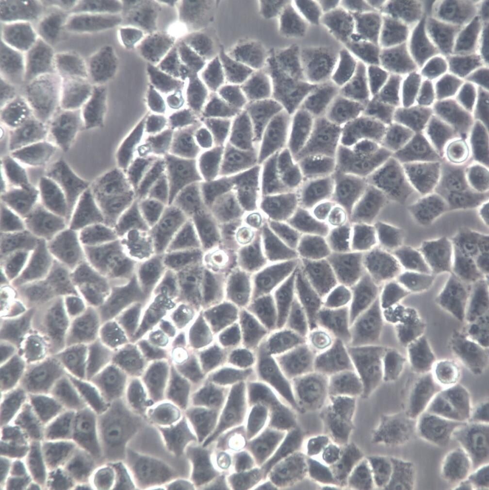 IOSE80细胞、IOSE80细胞系、IOSE80正常卵巢上皮细胞