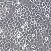 IOSE80细胞、IOSE80细胞系、IOSE80正常卵巢上皮细胞