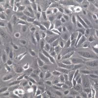 DU 145细胞、DU 145细胞系、DU 145前列腺癌细胞