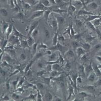 C918细胞、C918细胞系、C918眼脉络黑色素瘤细胞