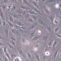 Daoy细胞、Daoy细胞系、Daoy髓母细胞瘤细胞