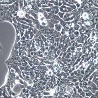 Detroit 562细胞、Detroit 562细胞系、Detroit 562咽头癌胸水转移细胞