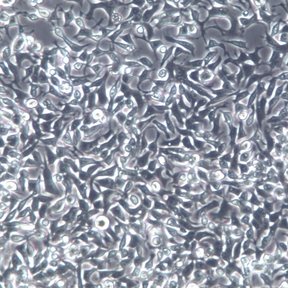 C666-1细胞、C666-1细胞系、C666-1鼻咽癌细胞