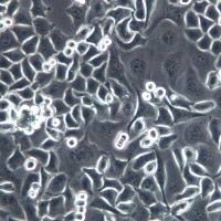 CNE-2Z细胞、CNE-2Z细胞系、CNE-2Z鼻咽癌细胞